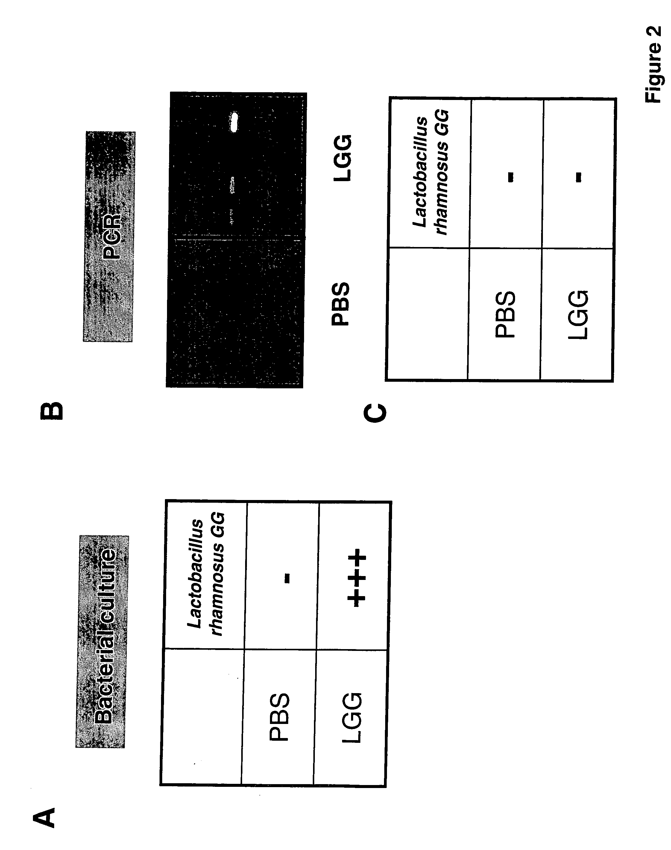 Method for preventing or treating the development of respiratory allergies