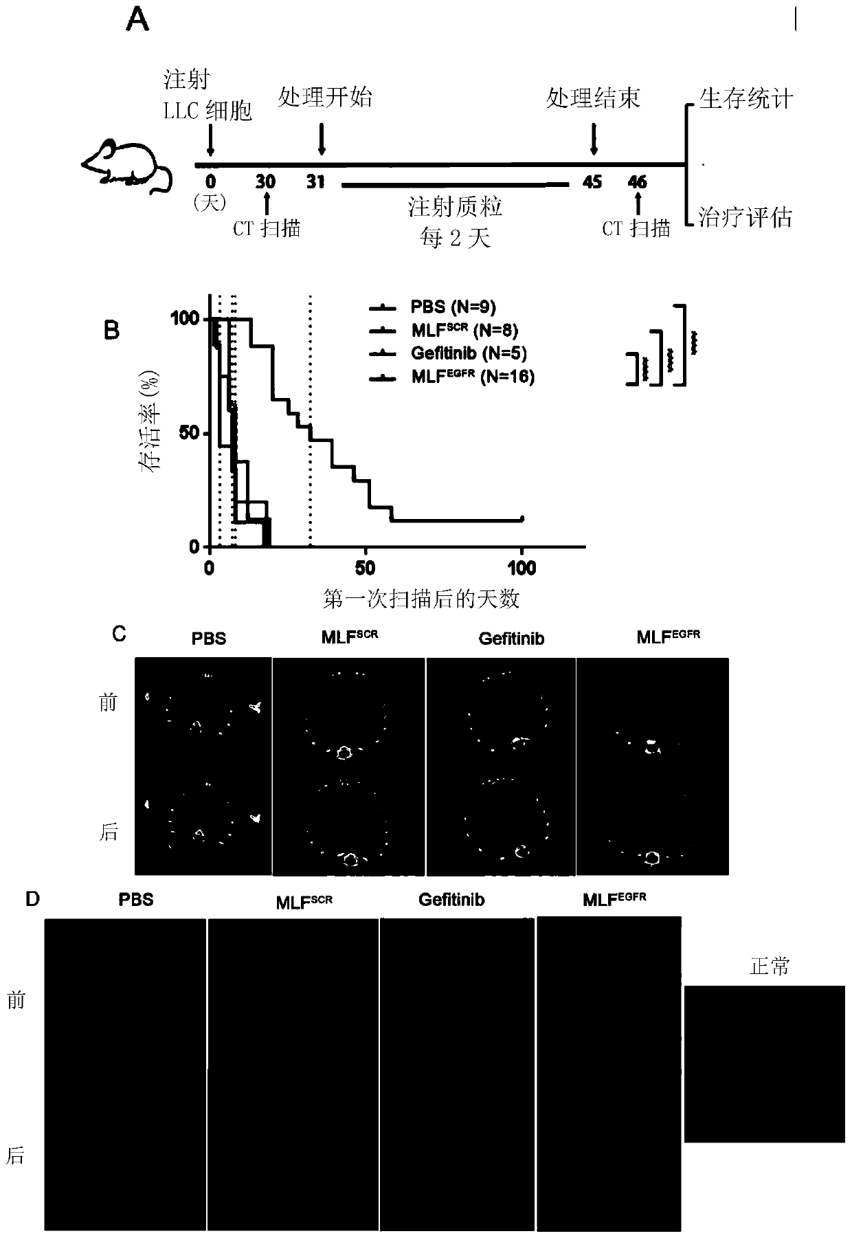 siRNA inhibiting EGFR expression as well as precursors and application of siRNA