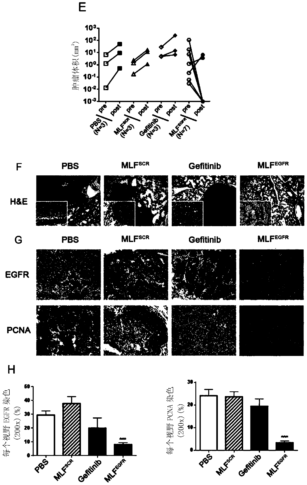 siRNA inhibiting EGFR expression as well as precursors and application of siRNA