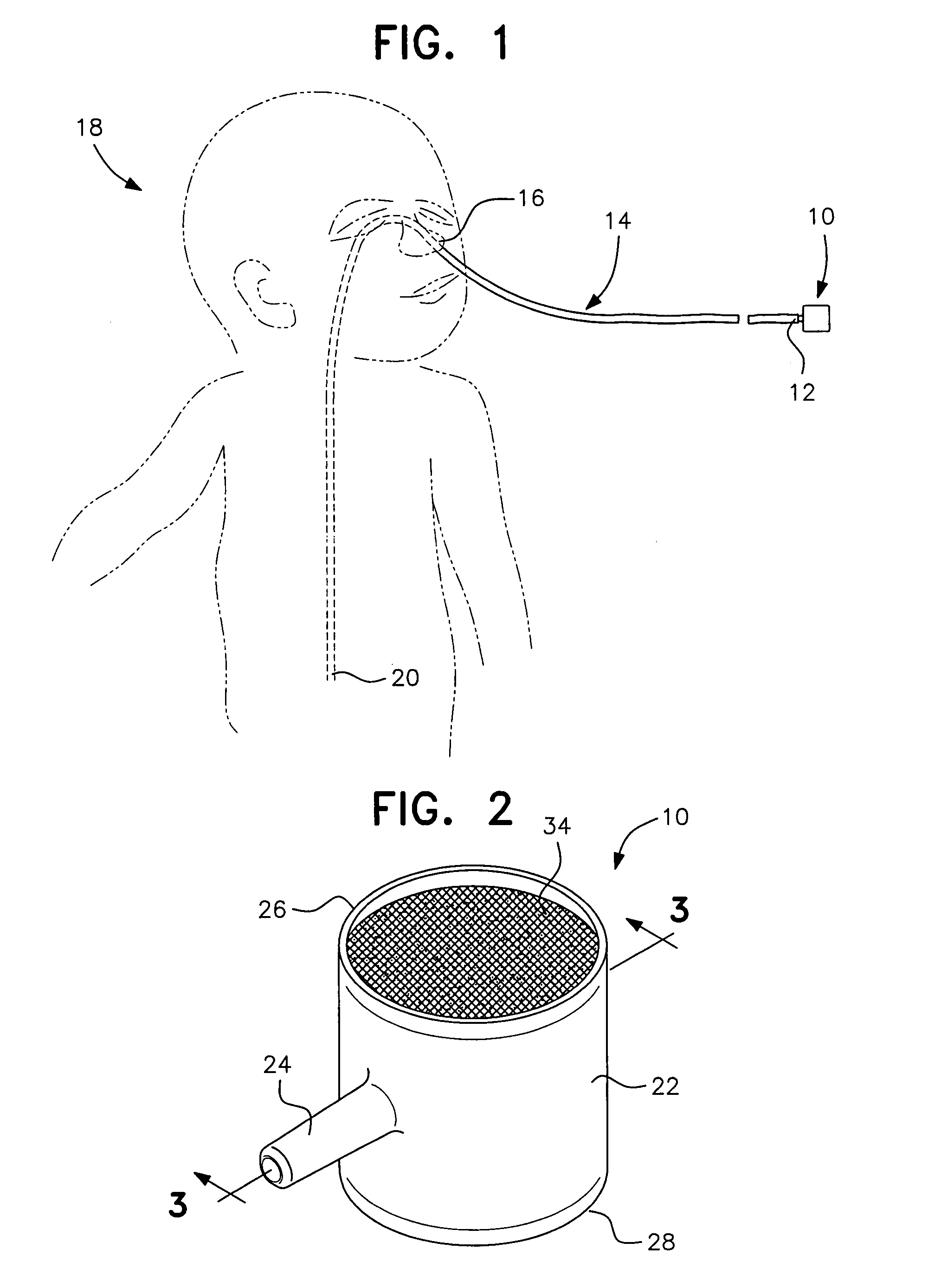 Pediatric nasal gastric vent tube