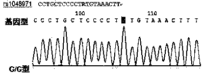 Detection kit for early diagnosis of systemic lupus erythematosus