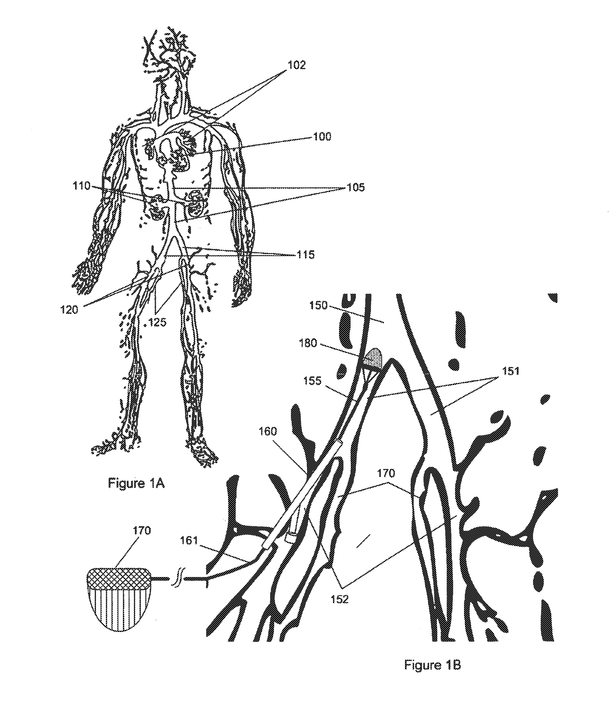 Electrostatic Vascular Filters