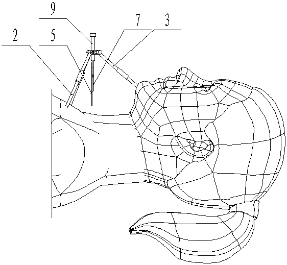 Thyroid surgical incision marker and utilization method thereof