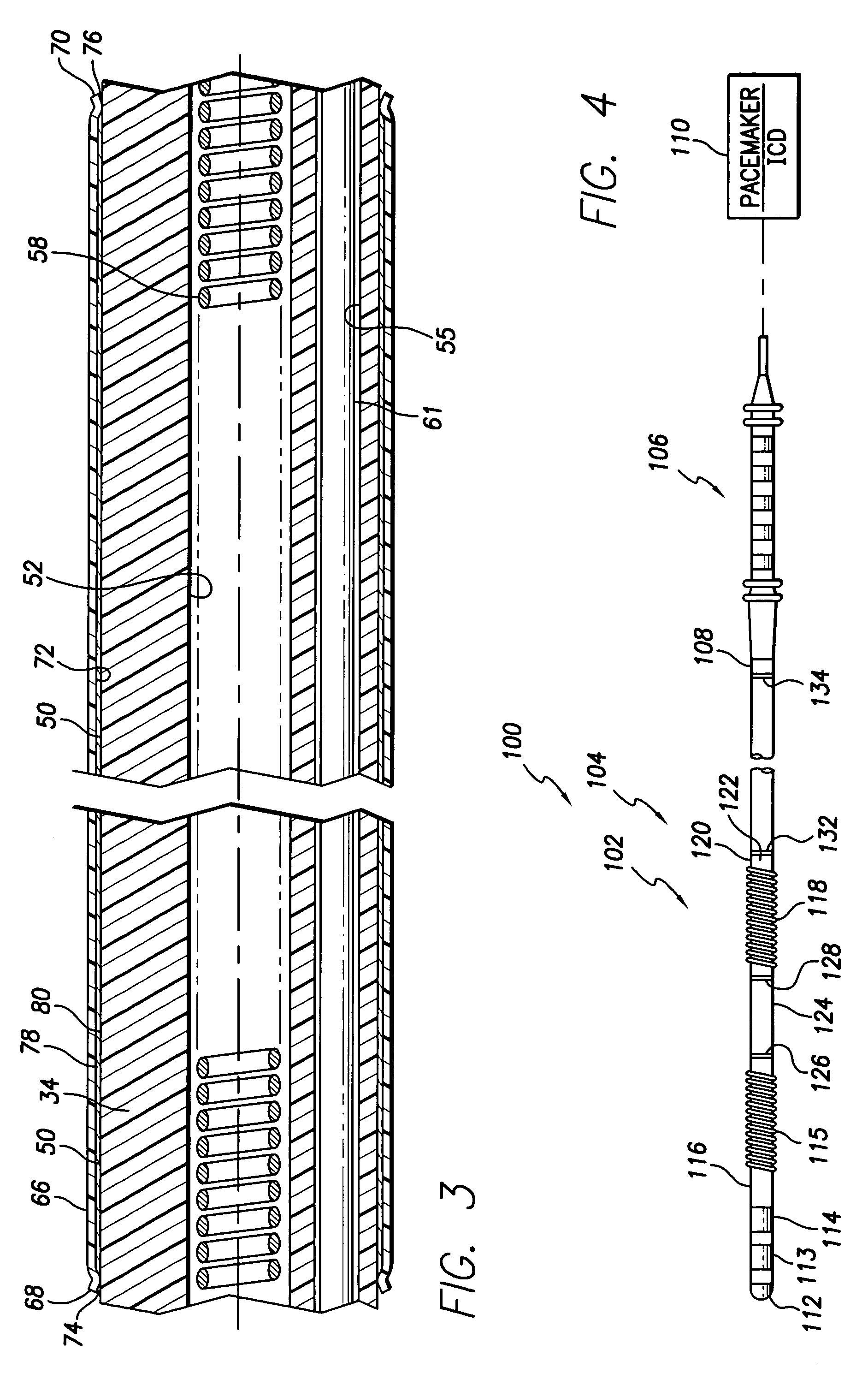 Abrasion-resistant implantable medical lead and a method of fabricating such a lead