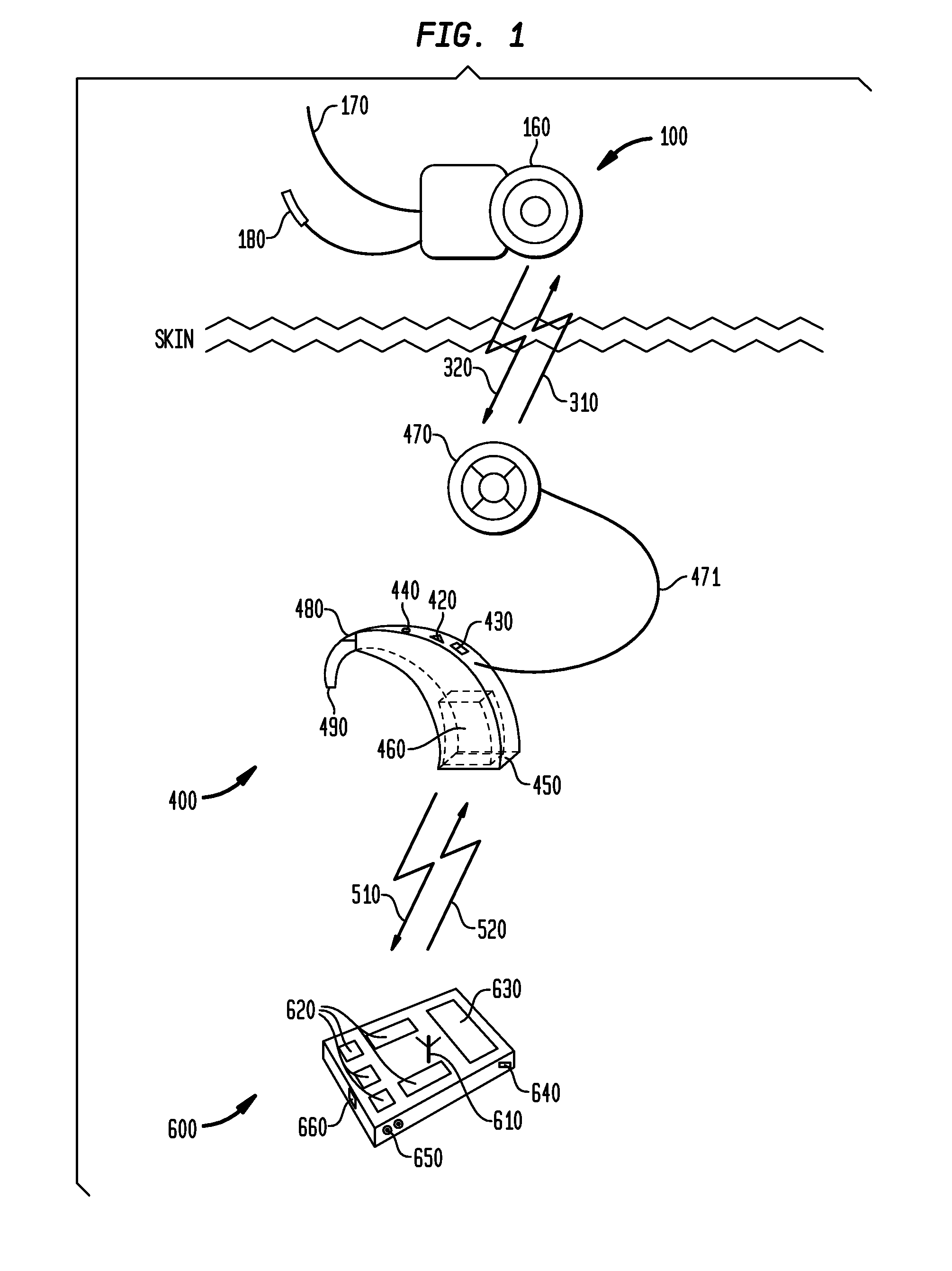 Wireless communication between devices of a hearing prosthesis