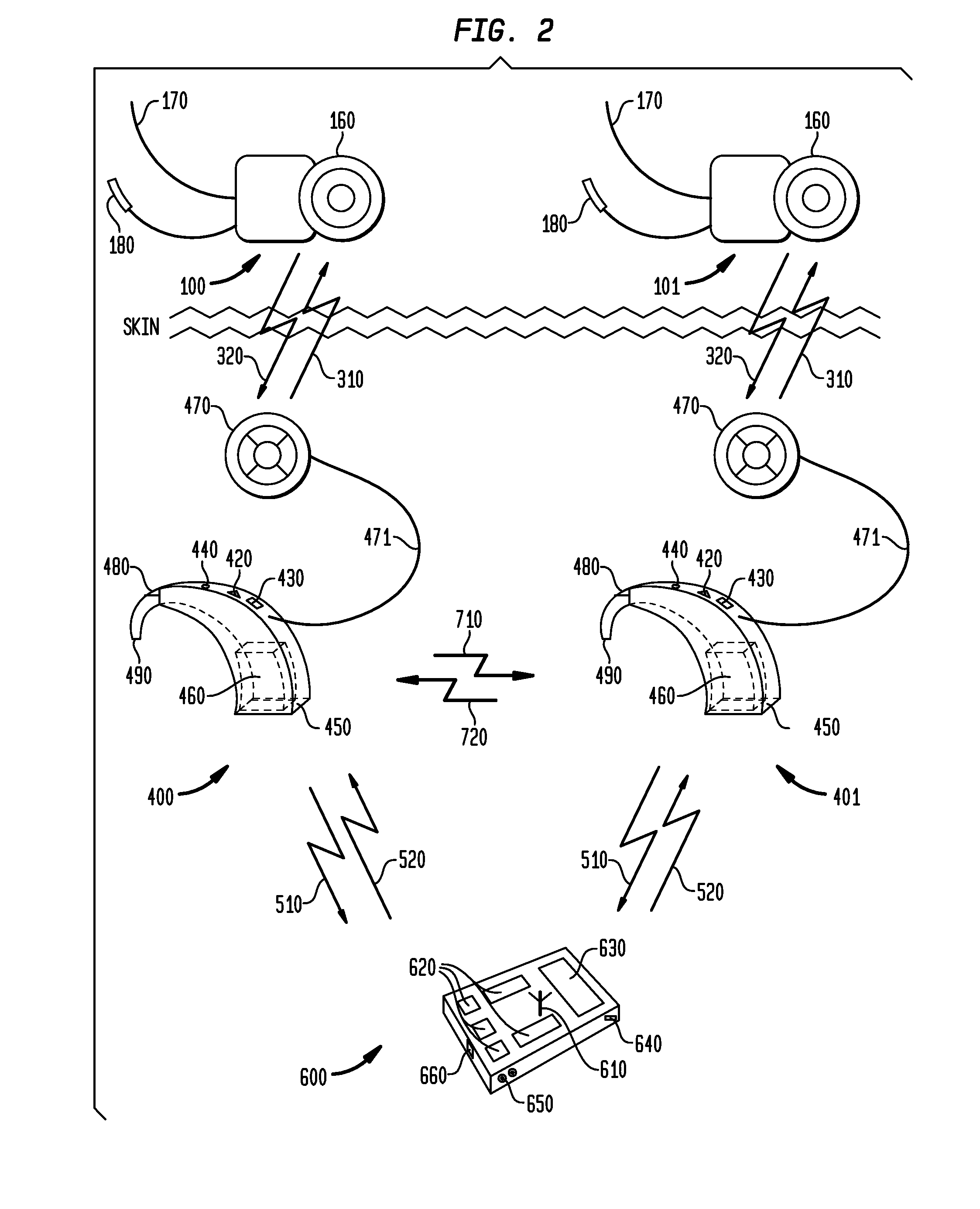 Wireless communication between devices of a hearing prosthesis