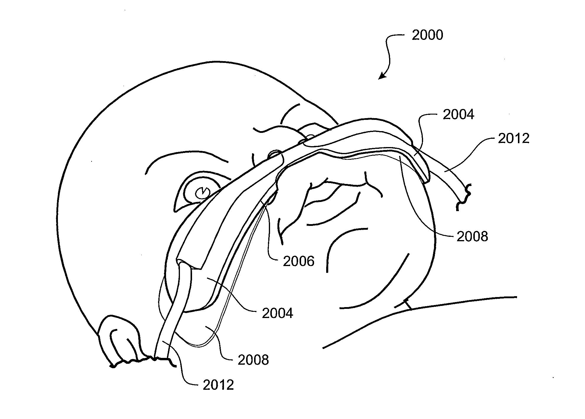 Tube securement system