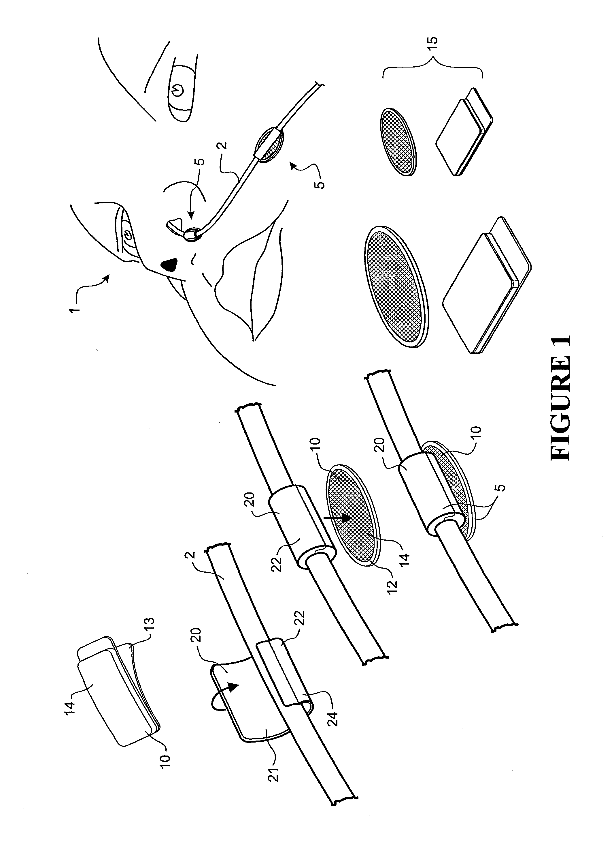 Tube securement system