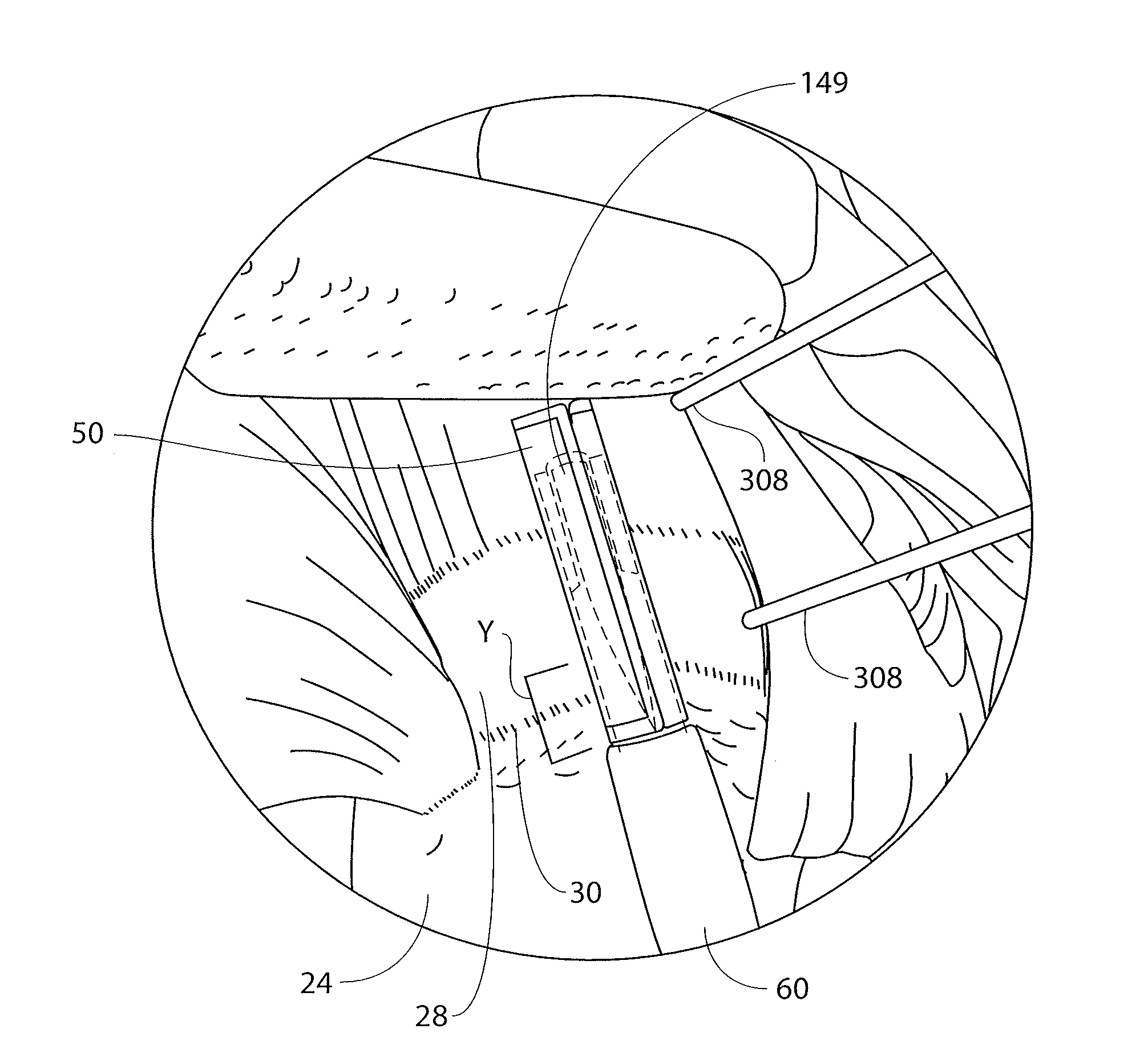 Methods and apparatus for delivering and positioning sheet-like materials in surgery