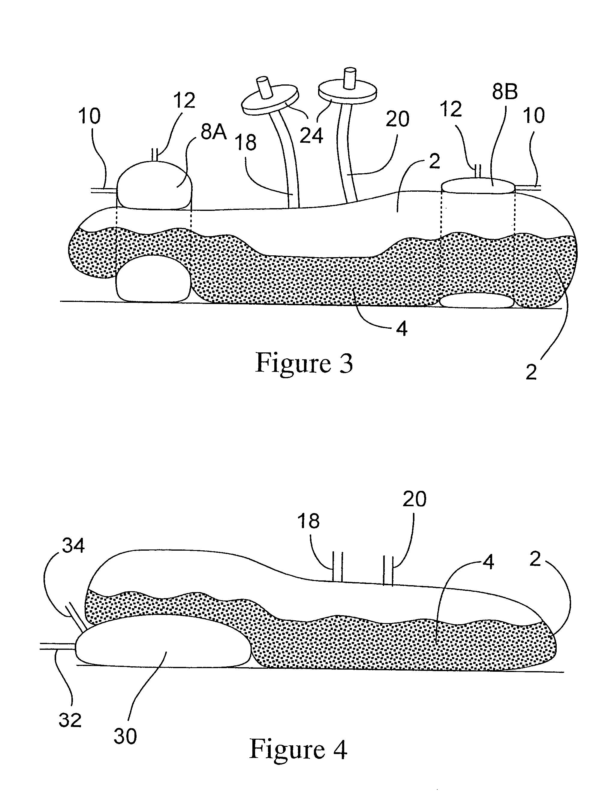 Disposable mixing system