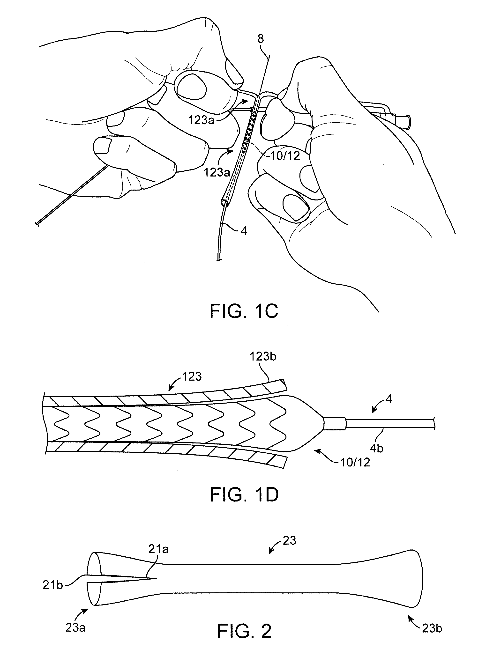 Sheaths Reducing Recoil and Loss of Retention for Polymer Scaffolds Crimped to Balloons