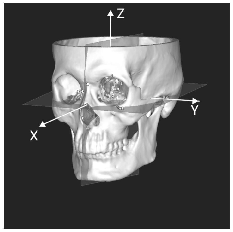 Method for obtaining mid-facial defect target reference data through anatomical feature point matching