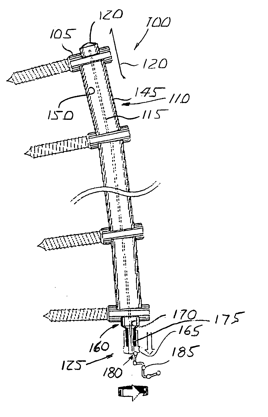 Apparatus for and method of aligning a spine