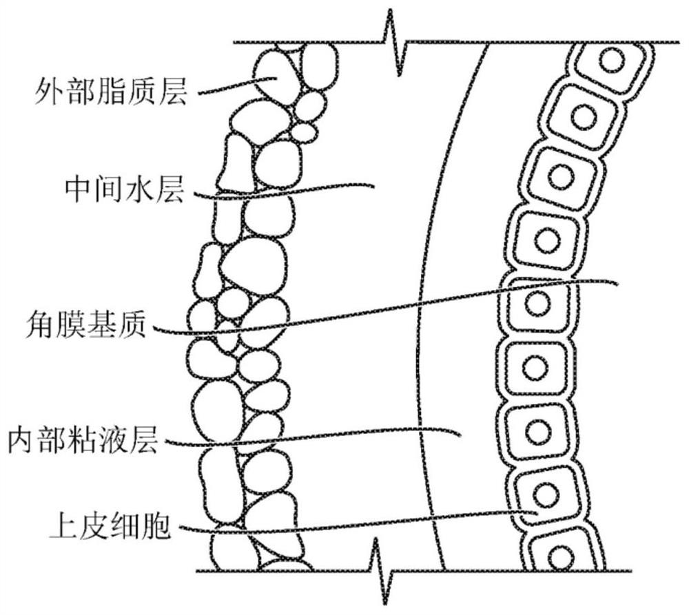 Sap and peptidomimetics for treatment of eye disease