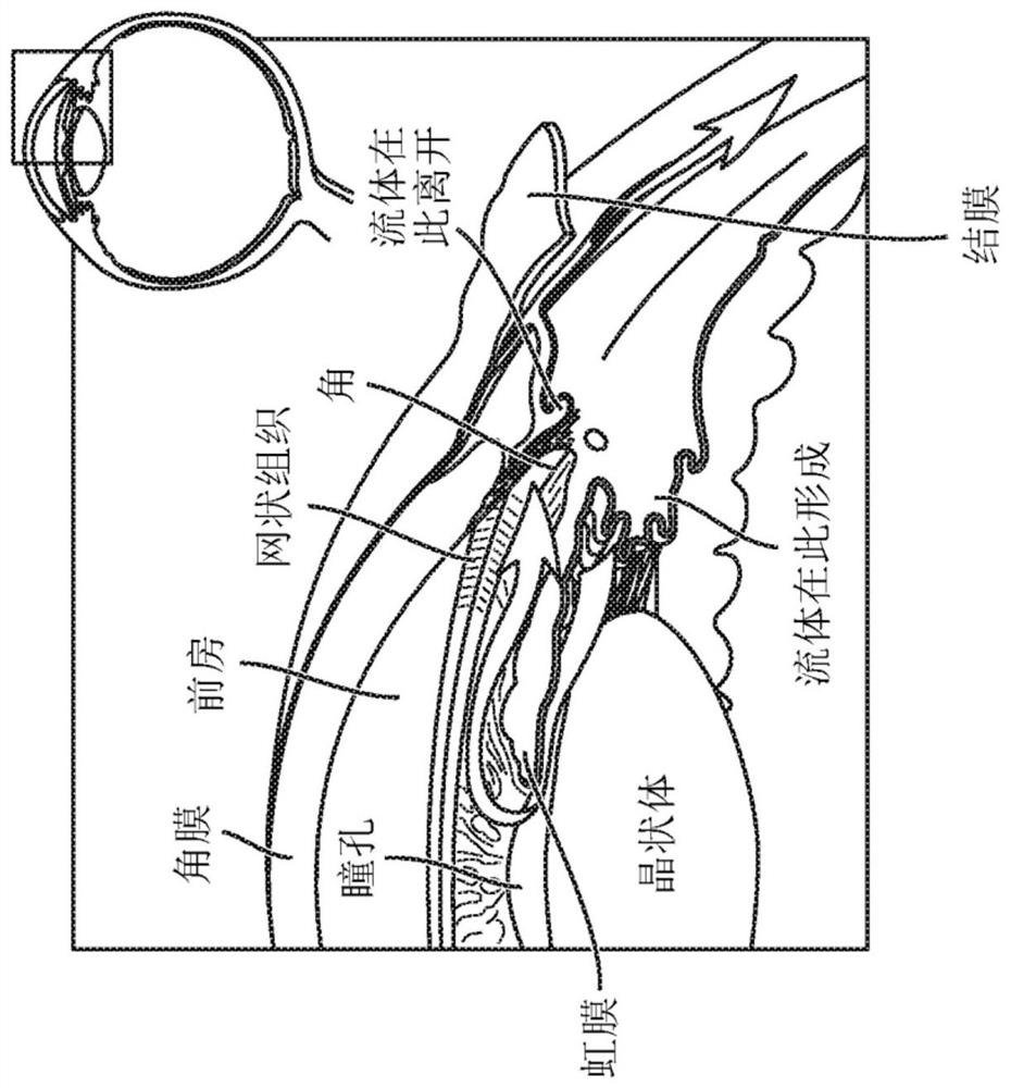 Sap and peptidomimetics for treatment of eye disease