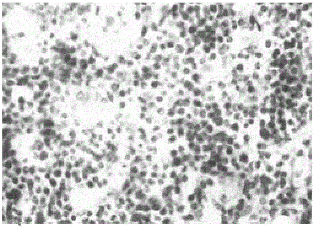 Compound for treating bone marrow injury caused by radiotherapy and chemotherapy