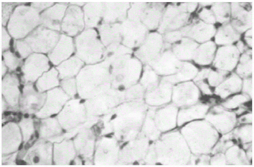 Compound for treating bone marrow injury caused by radiotherapy and chemotherapy