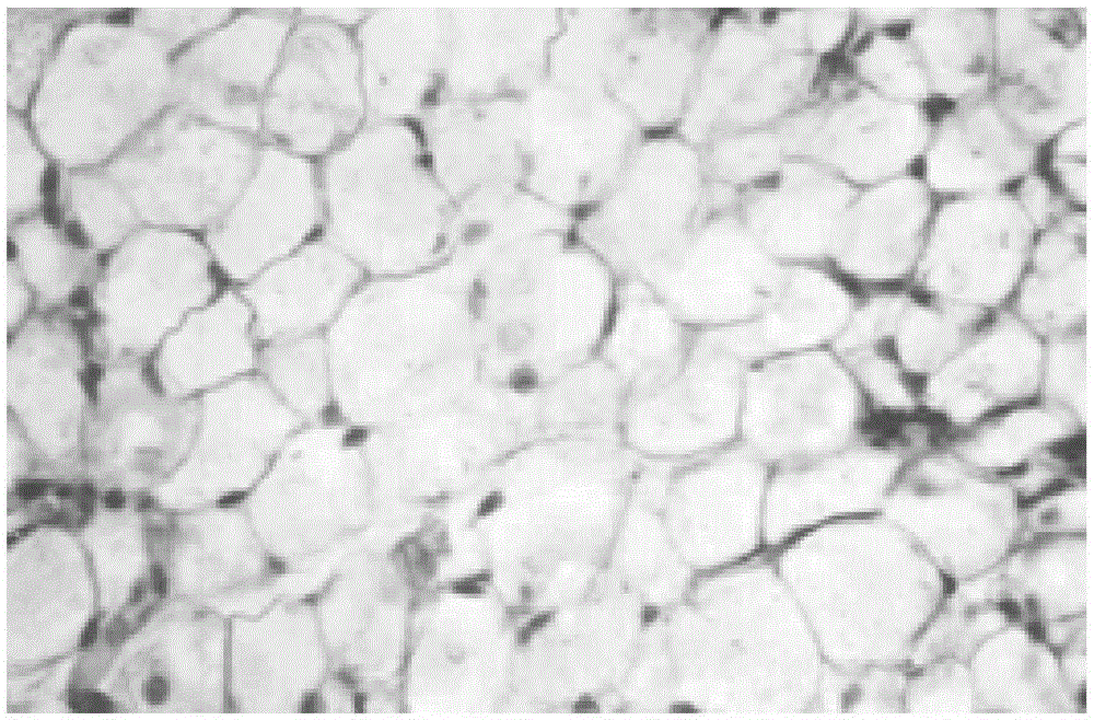 Compound for treating bone marrow injury caused by radiotherapy and chemotherapy