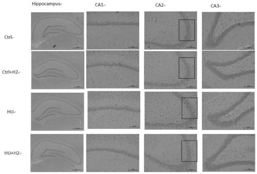 Application of hydrogen in preparation of composition for preventing or treating oxidative stress injury of brain