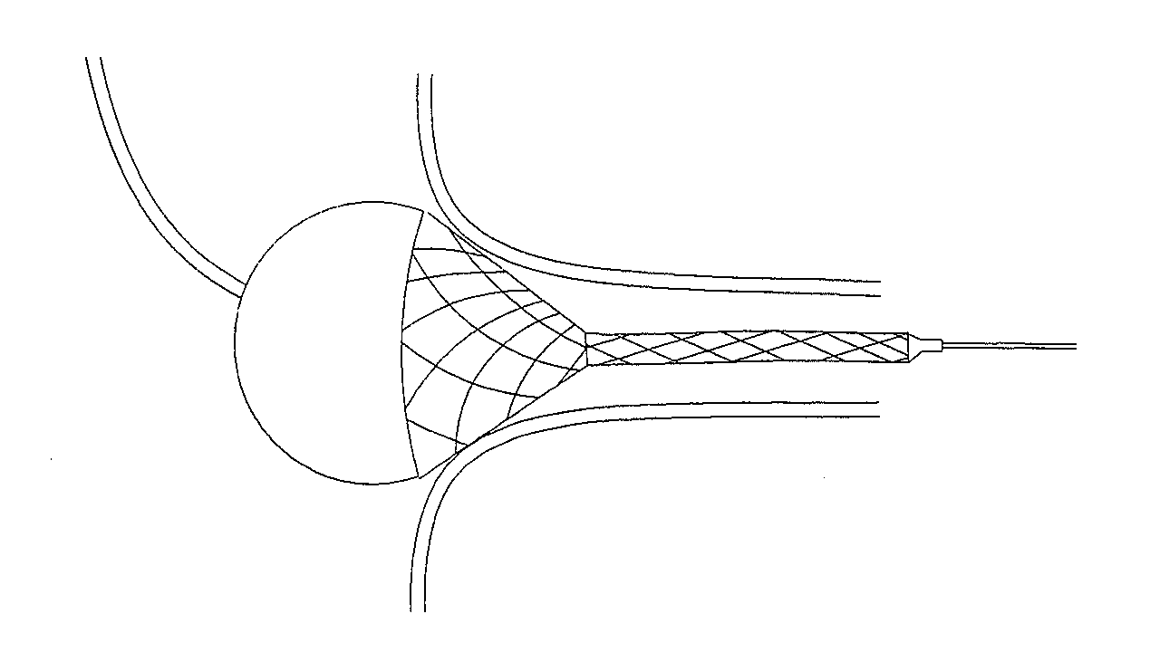Flared stents and apparatus and methods for delivering them