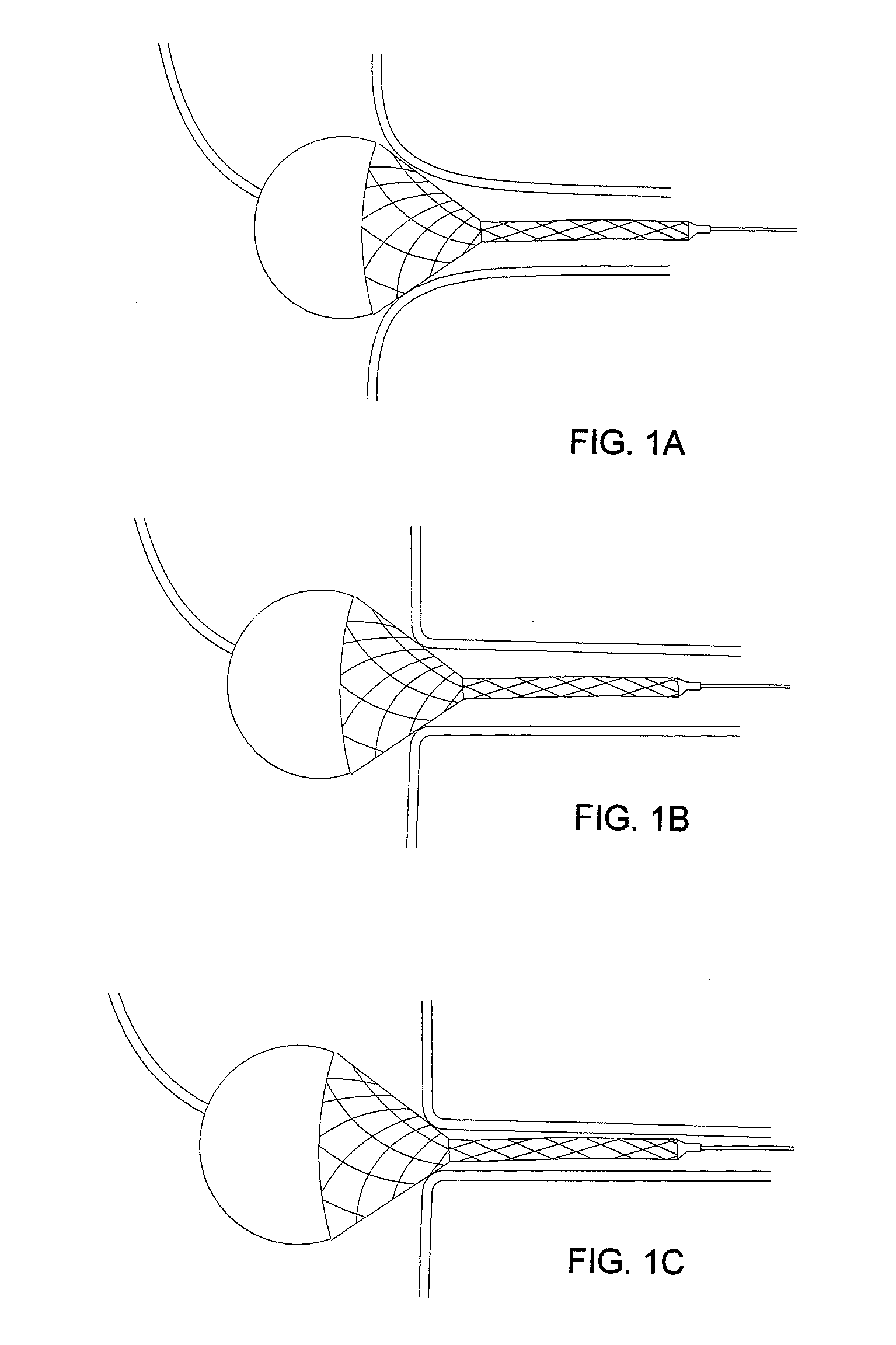 Flared stents and apparatus and methods for delivering them