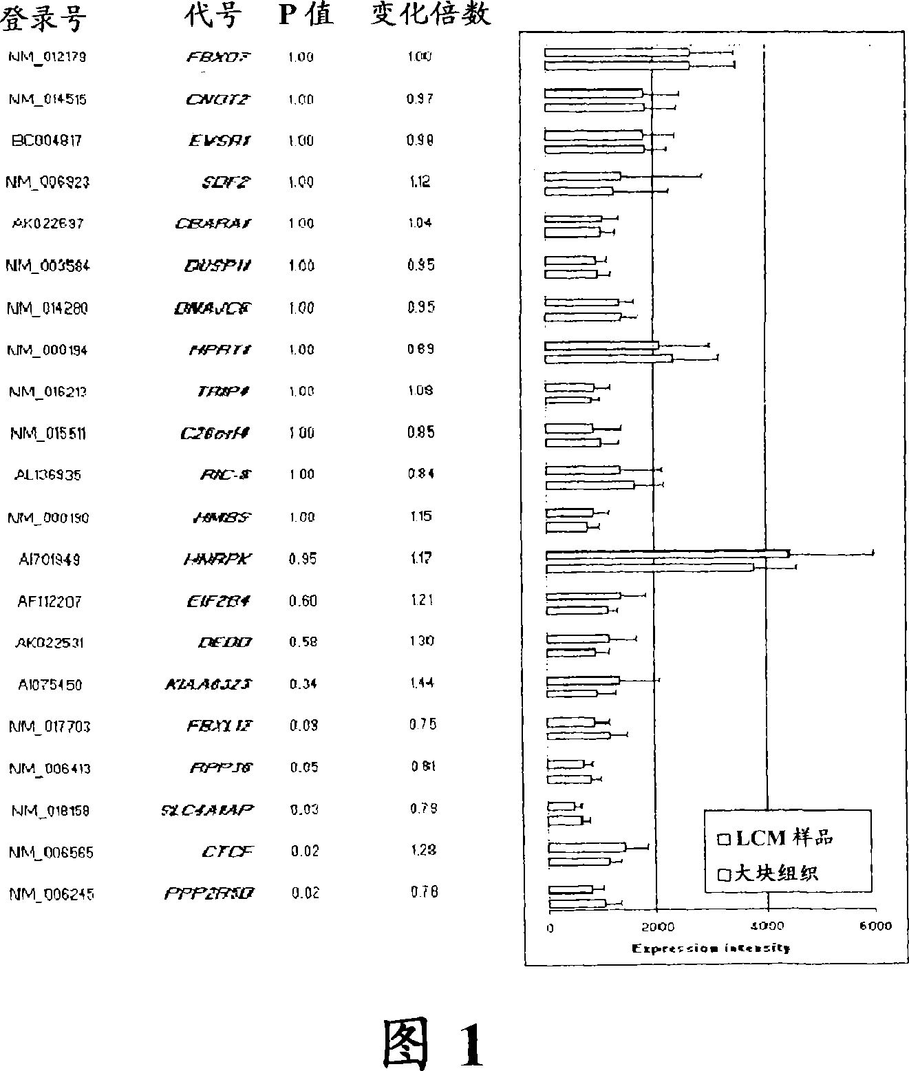 Laser microdissection and microarray analysis of breast tumors reveal estrogen receptor related genes and pathways