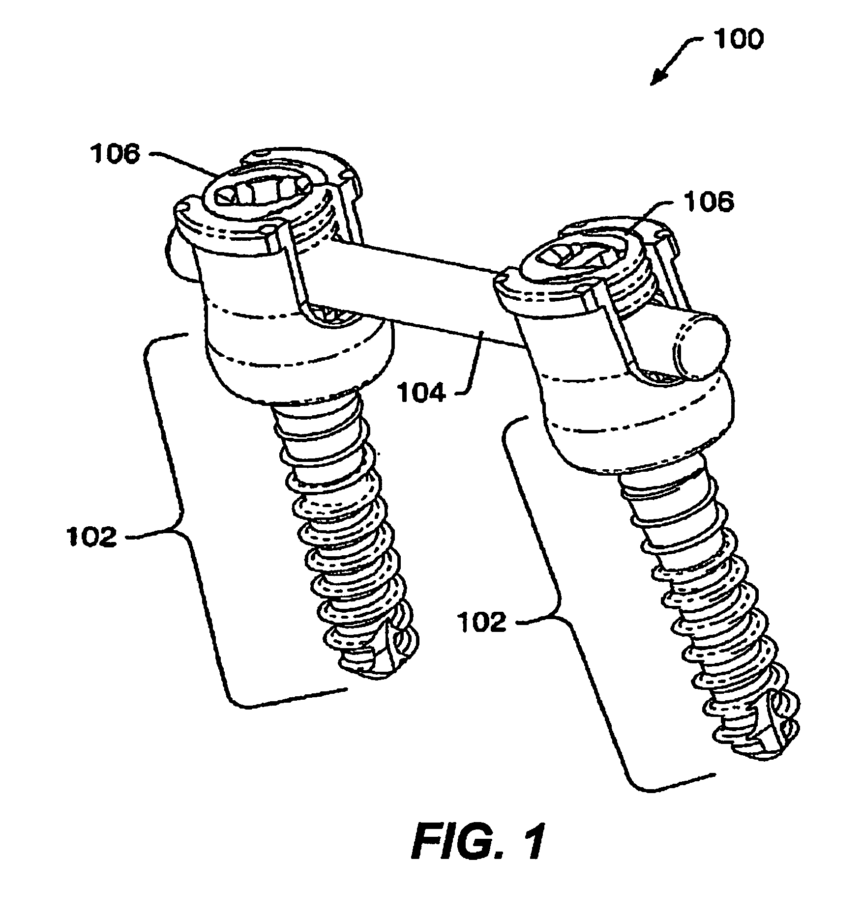 Dynamic spine stabilization system