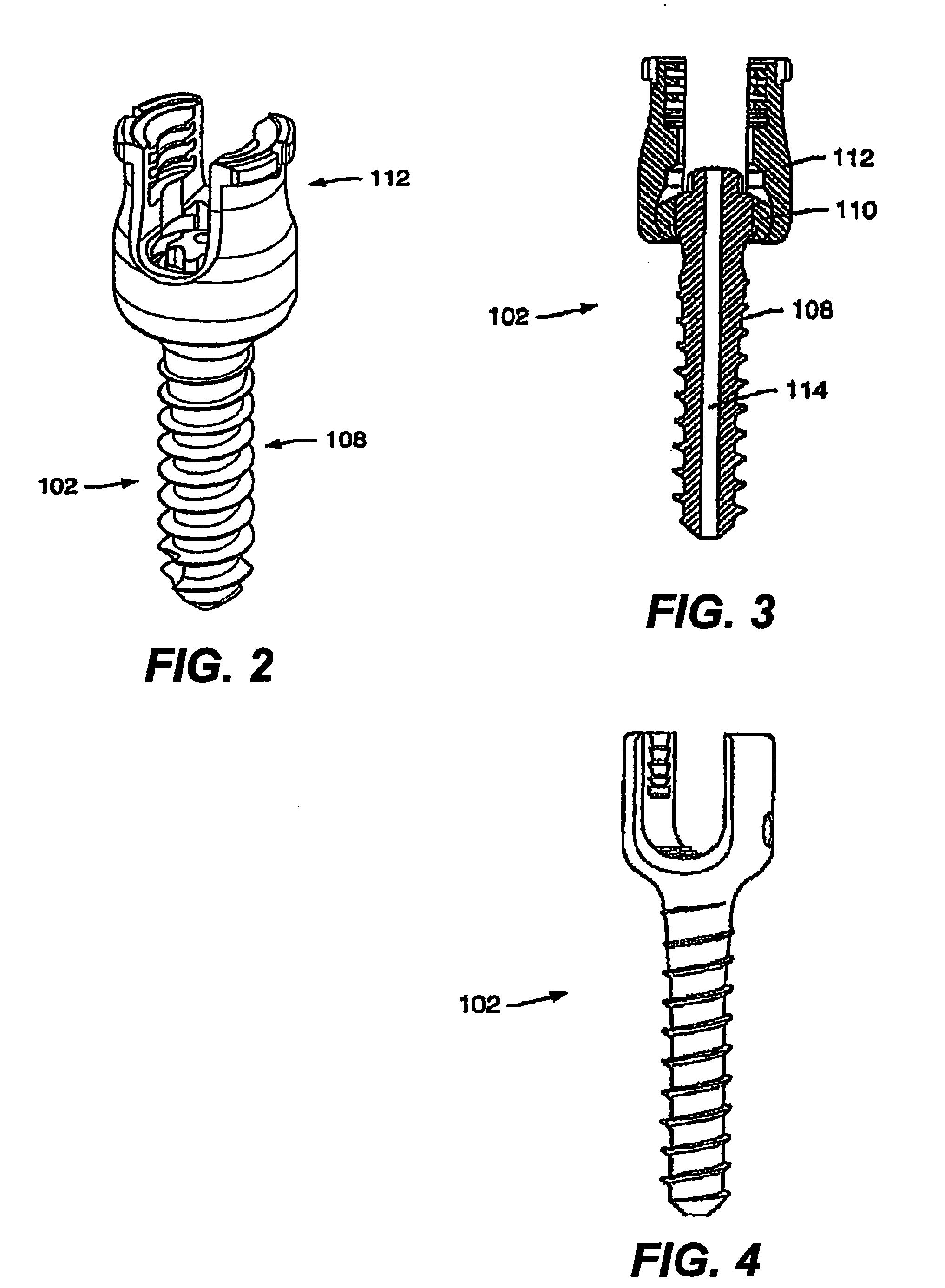 Dynamic spine stabilization system