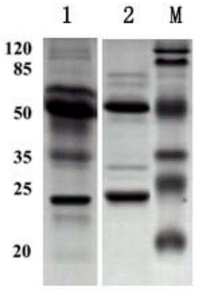 Toxoplasma detection kit