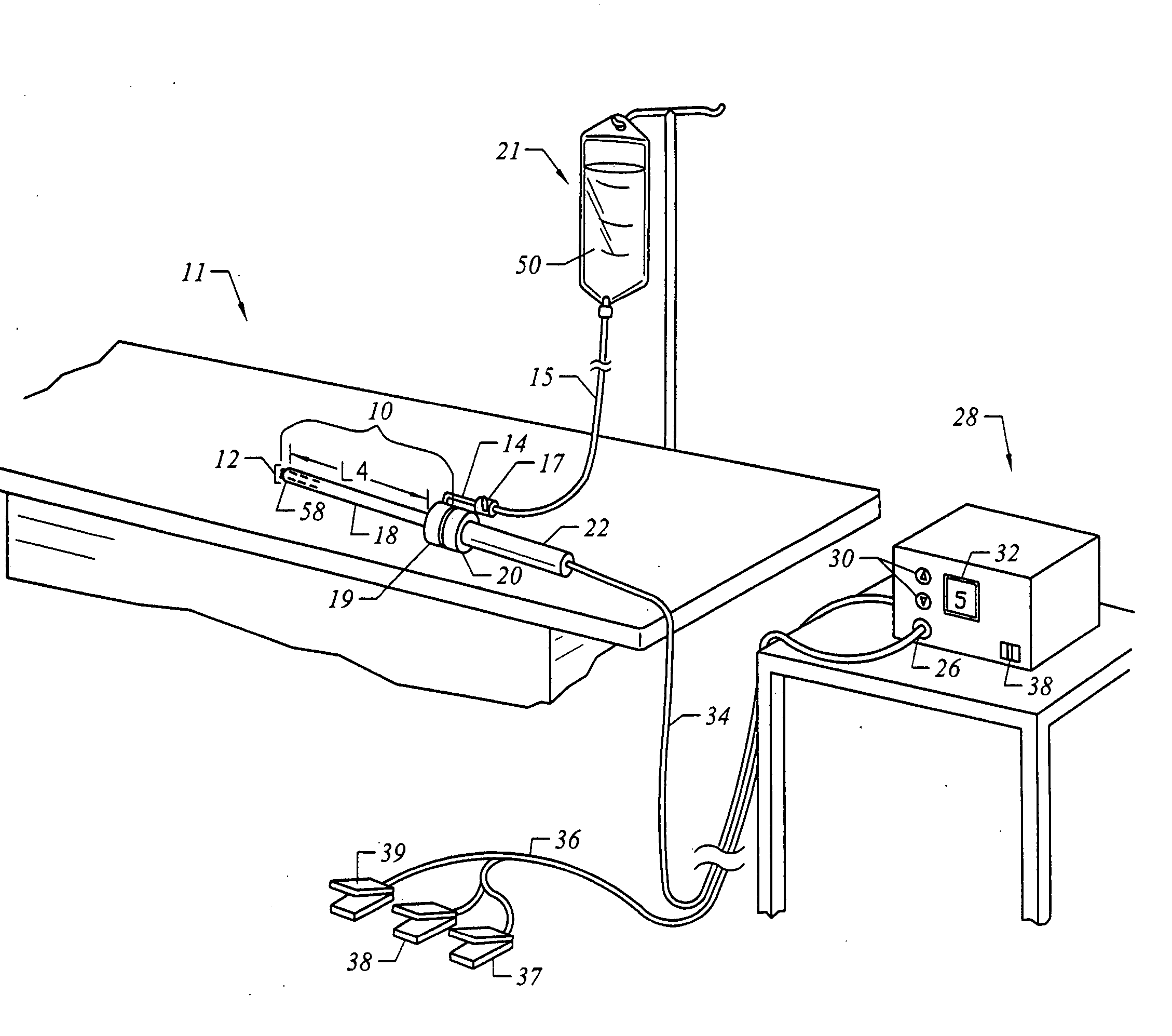 Bipolar electrosurgical clamp for removing and modifying tissue