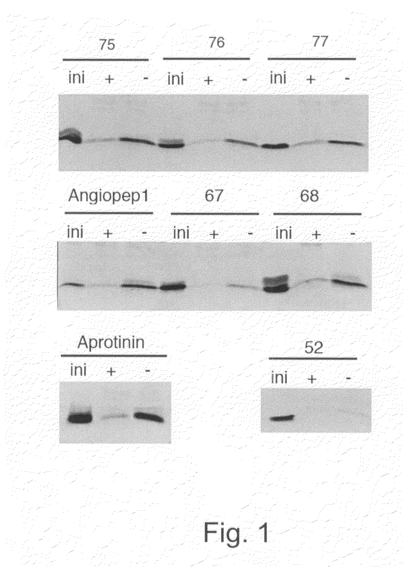 Delivery of antibodies to the central nervous system