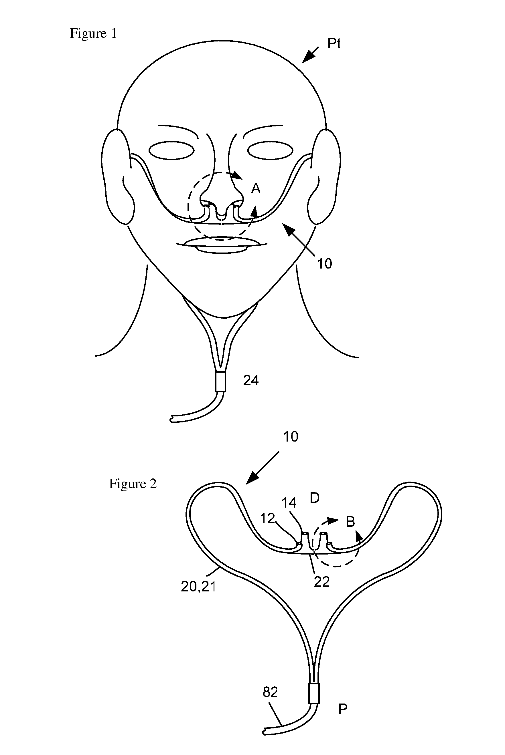 Nasal Ventilation Cannula System and Methods