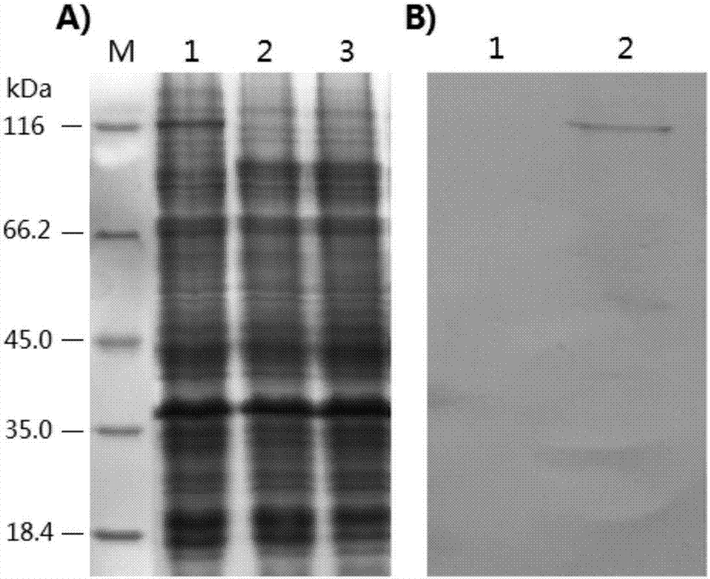 Recombinant lactobacillus for simultaneously expressing clostridium perfringens alpha, beta 2, epsilon and beta 1 exotoxin, construction method of recombinant lactobacillus and application