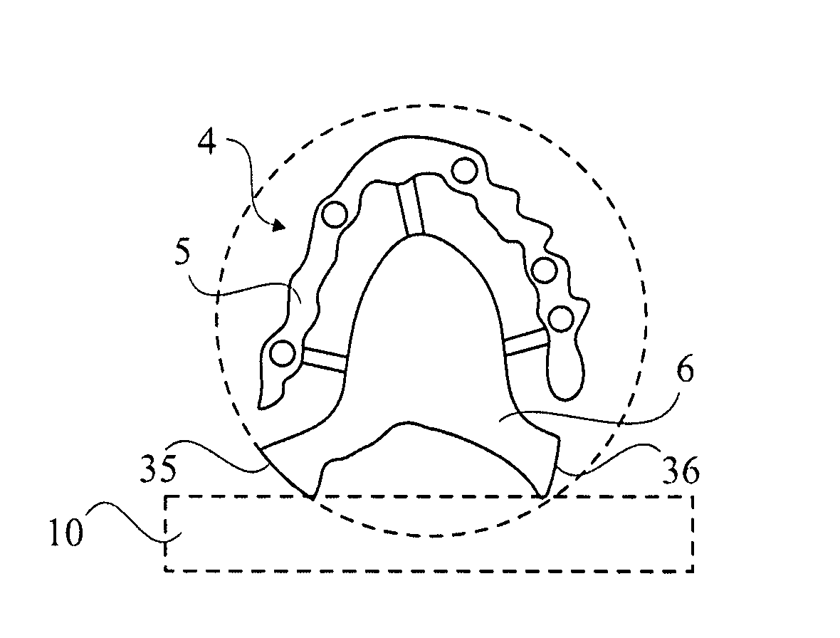 Method and arrangement for forming a dental bridge