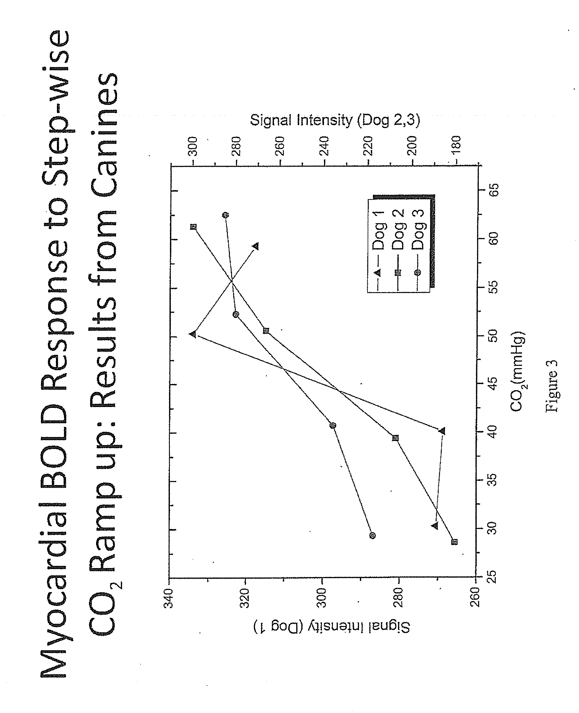 Assessment of coronary heart disease with carbon dioxide