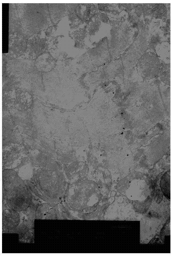 Compound sodium bicarbonate injection and preparation method thereof