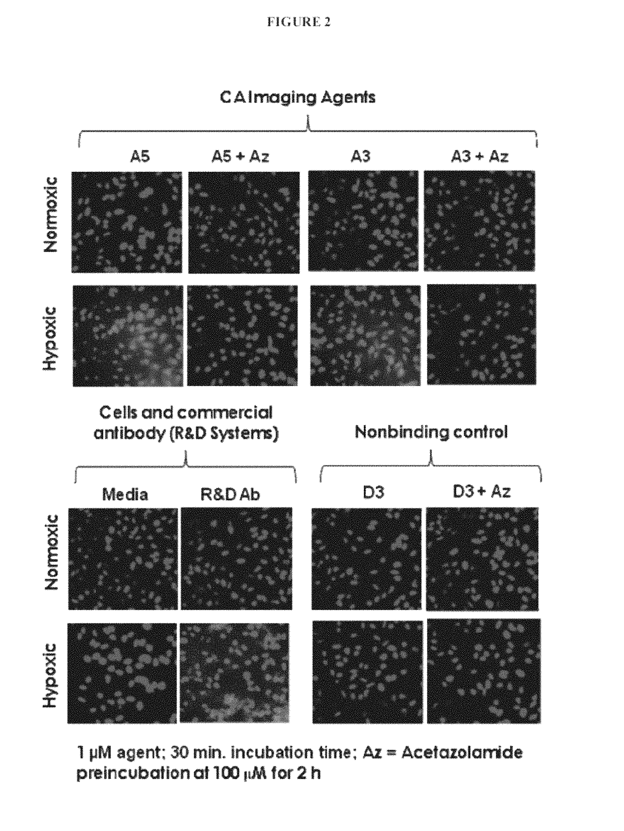 Carbonic anhydrase targeting agents and methods of using same