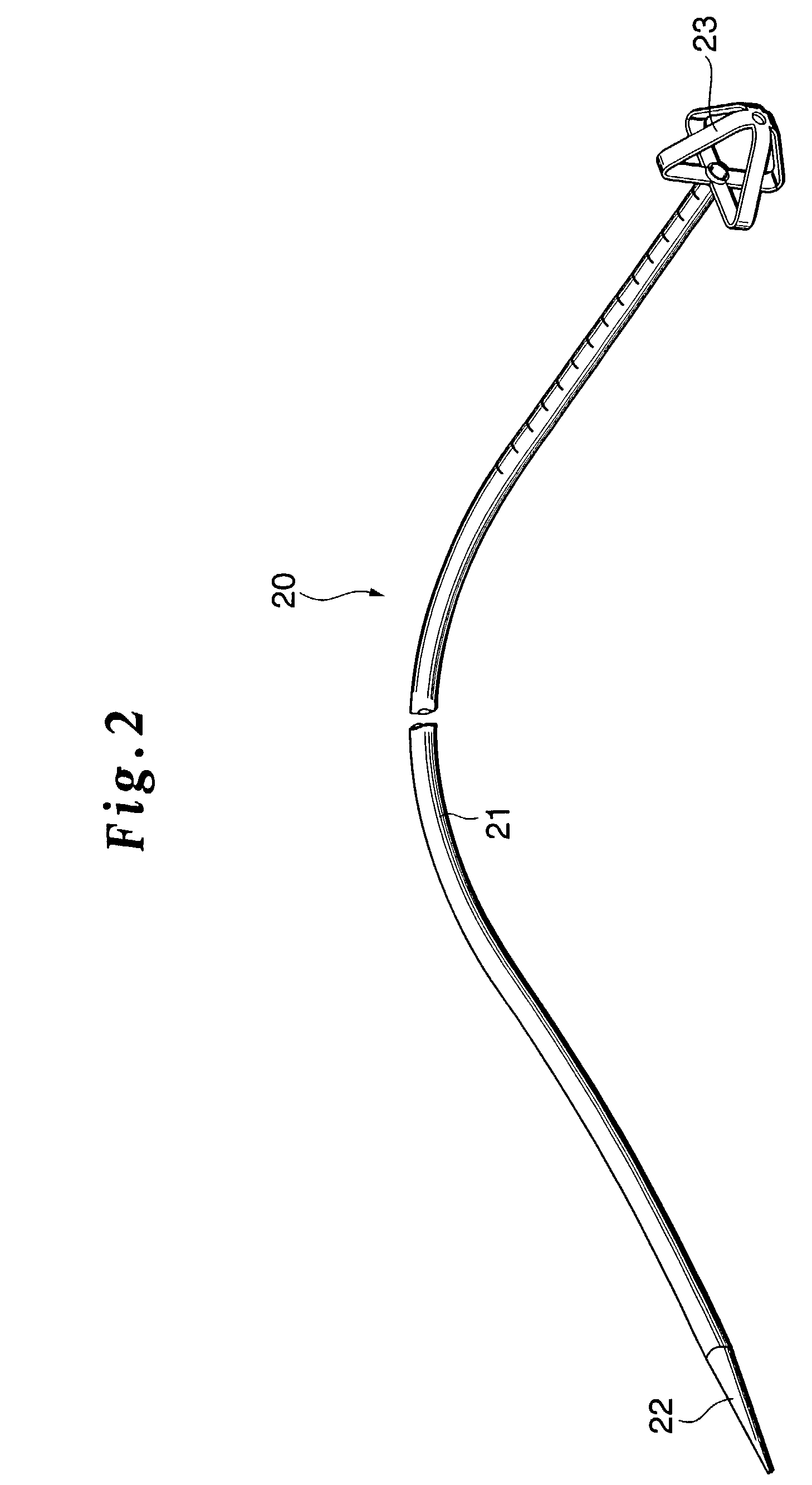 Method of gastrostomy, and an infection preventive cover, or catheter kit, and a gastrostomy catheter