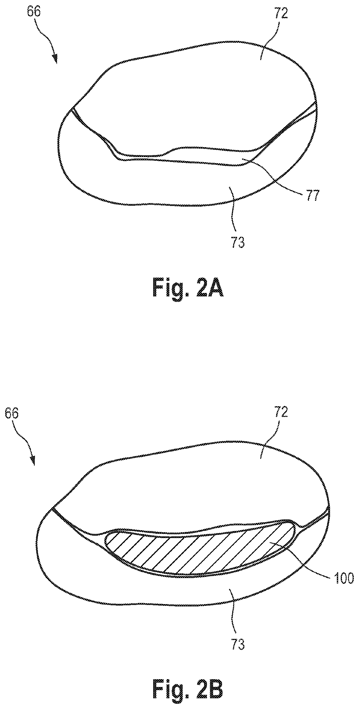 Prosthetic mitral valve coaptation enhancement device