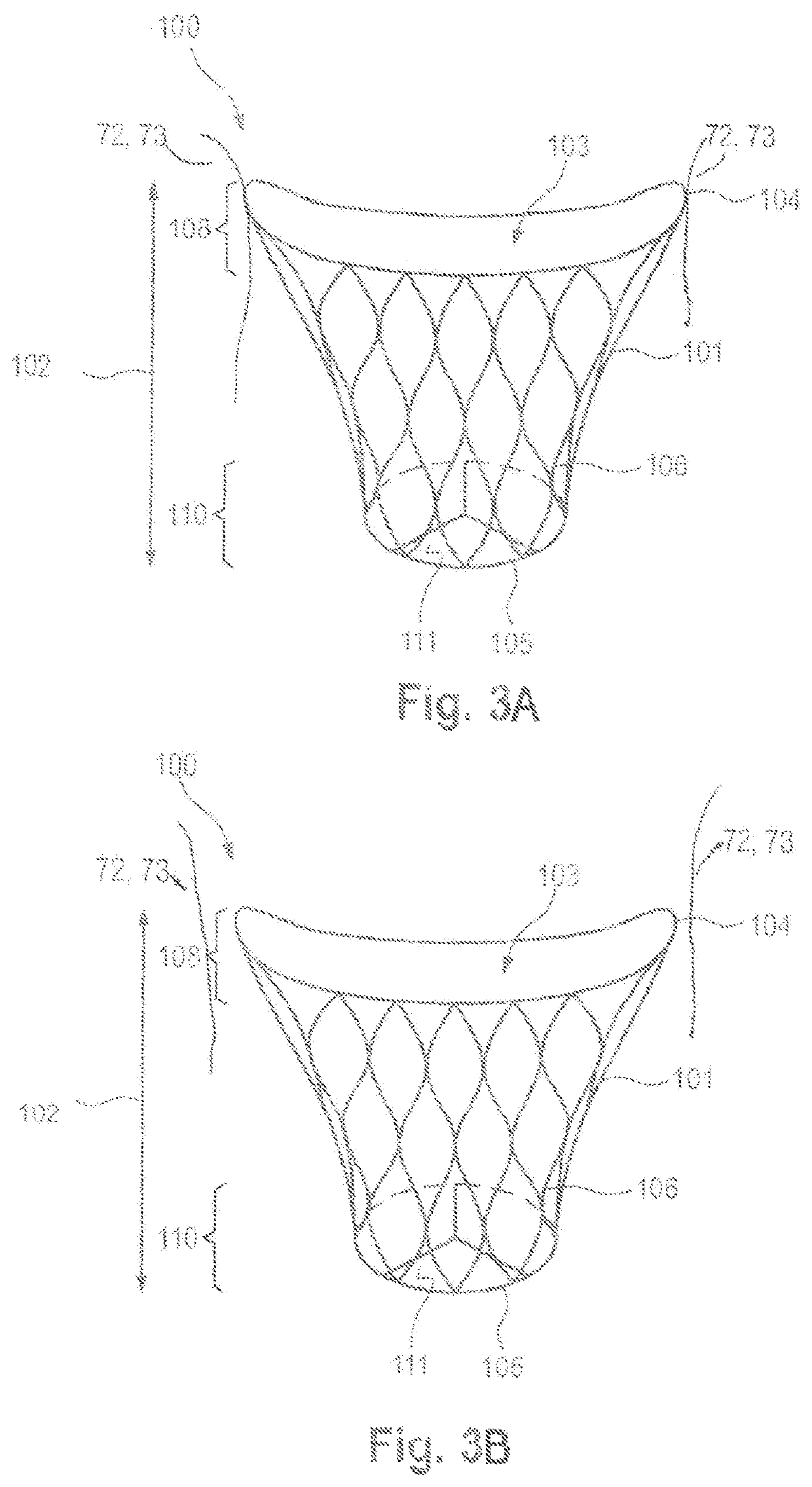 Prosthetic mitral valve coaptation enhancement device