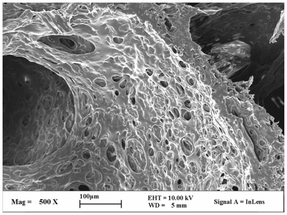 Composite sponge, preparation method thereof, negative pressure drainage dressing, device and medical equipment