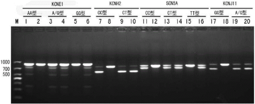 Sudden cardiac death rapid gene detection kit and detection method