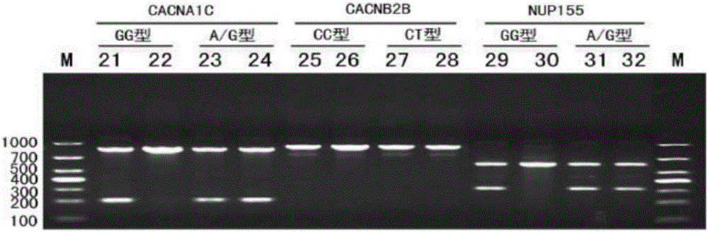 Sudden cardiac death rapid gene detection kit and detection method