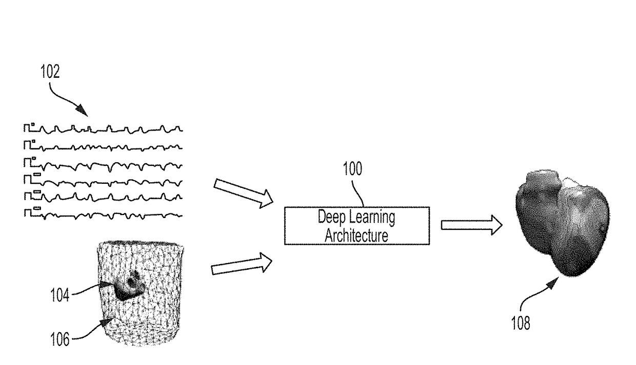 System and method for deep learning based cardiac electrophysiology model personalization