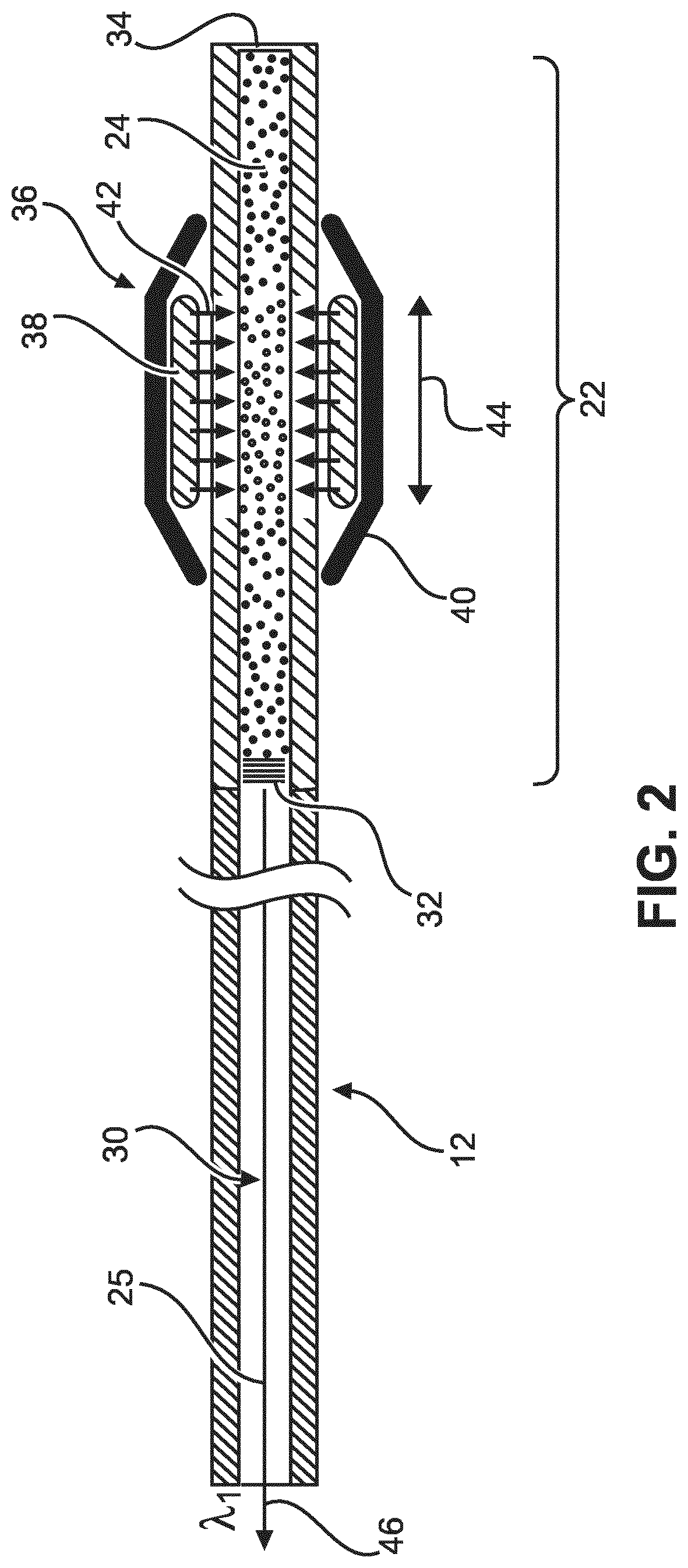 Supply of a sensor of an interventional device