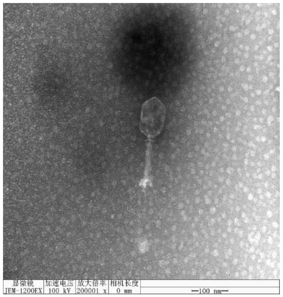 A drug-resistant Klebsiella pneumoniae phage rdp-kp-20004 and its application