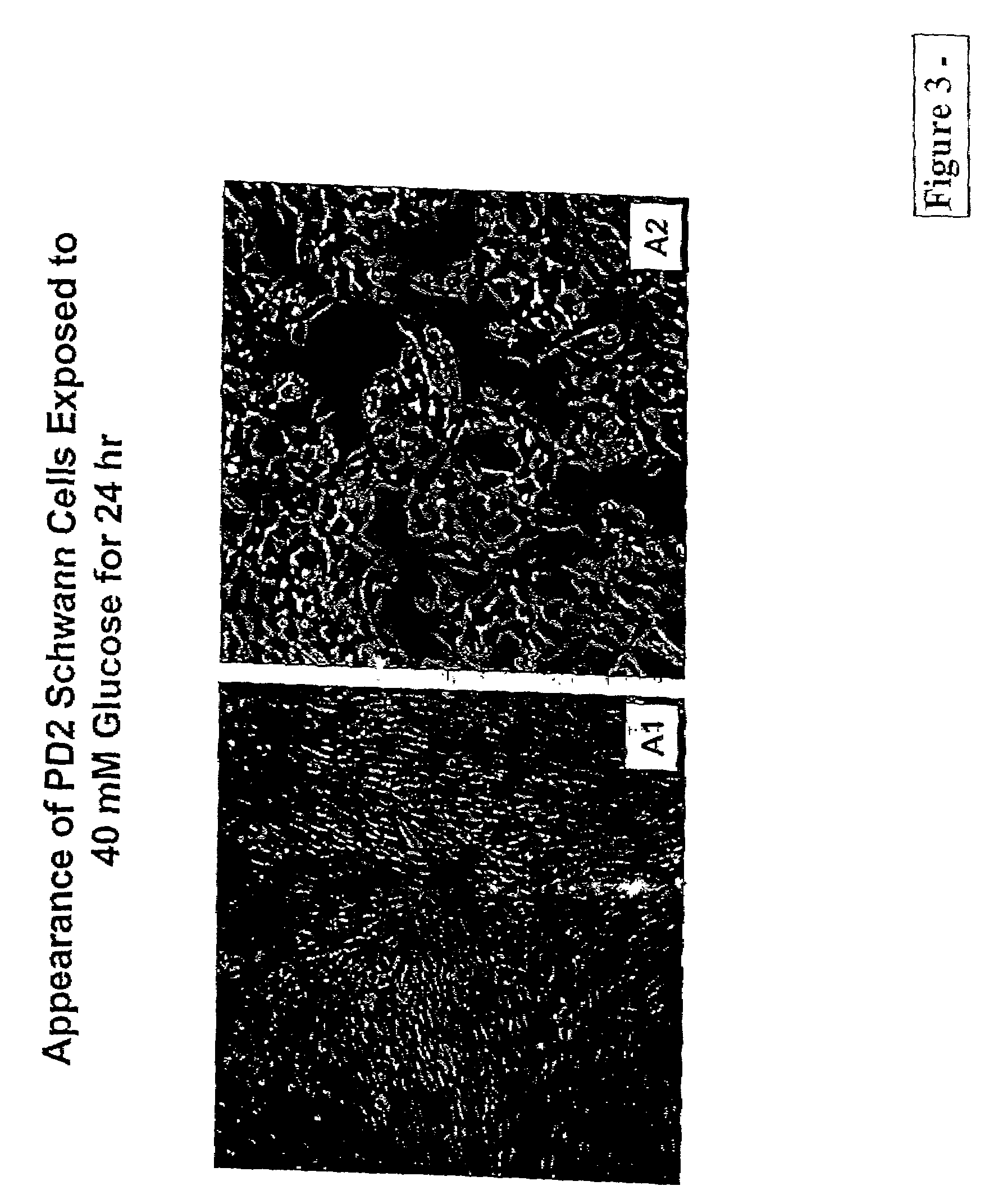 Methods for increasing schwann cell survival