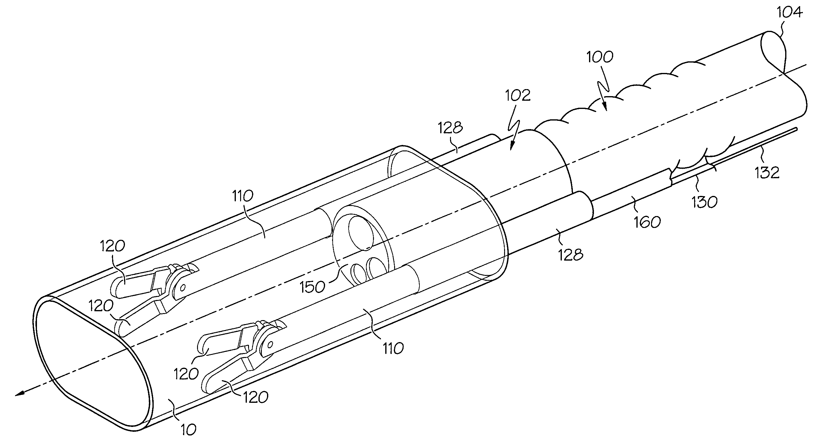 Lumen stabilizer for endoscopic mucosal resection