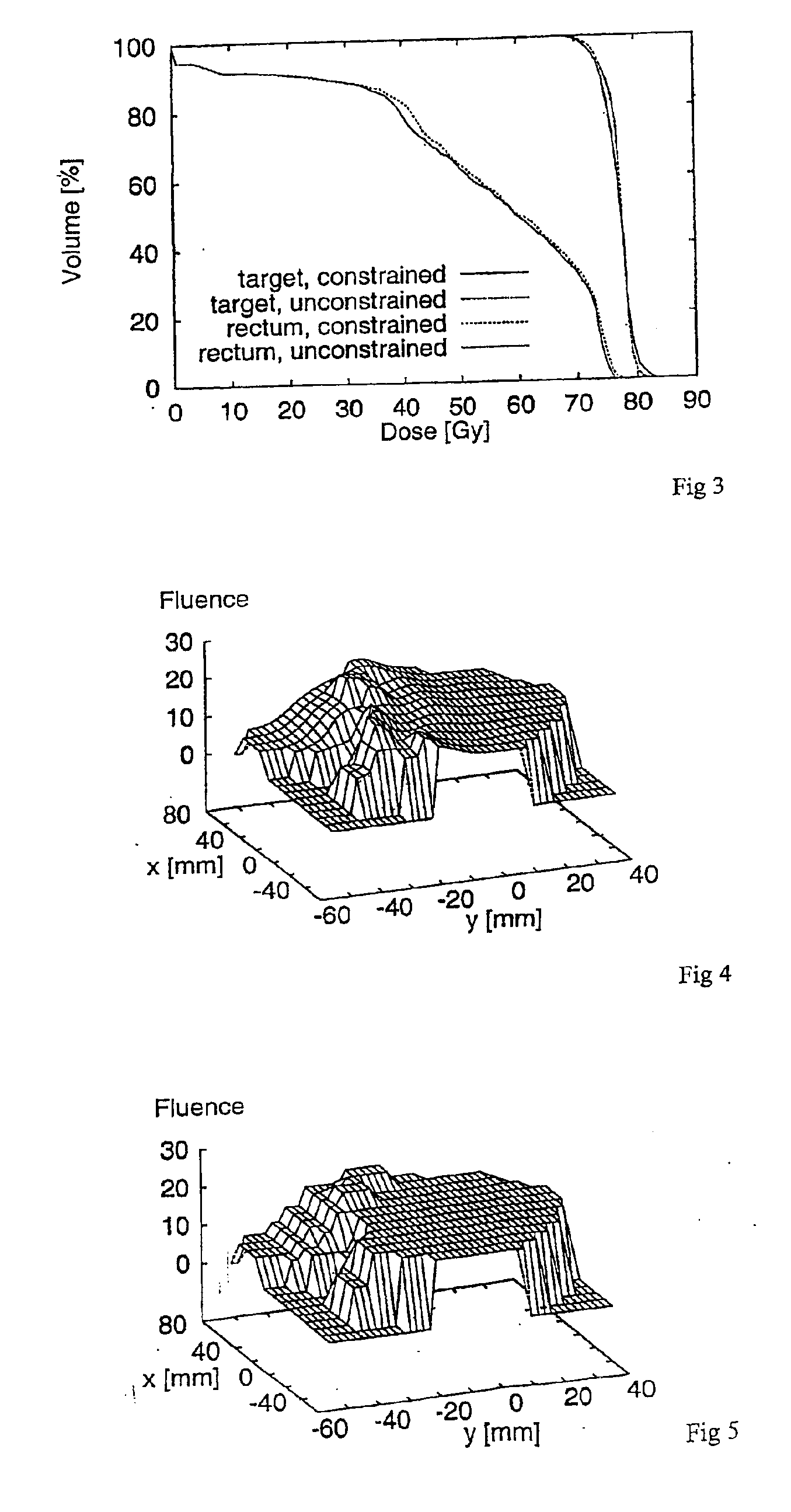 Radiotherapeutic apparatus