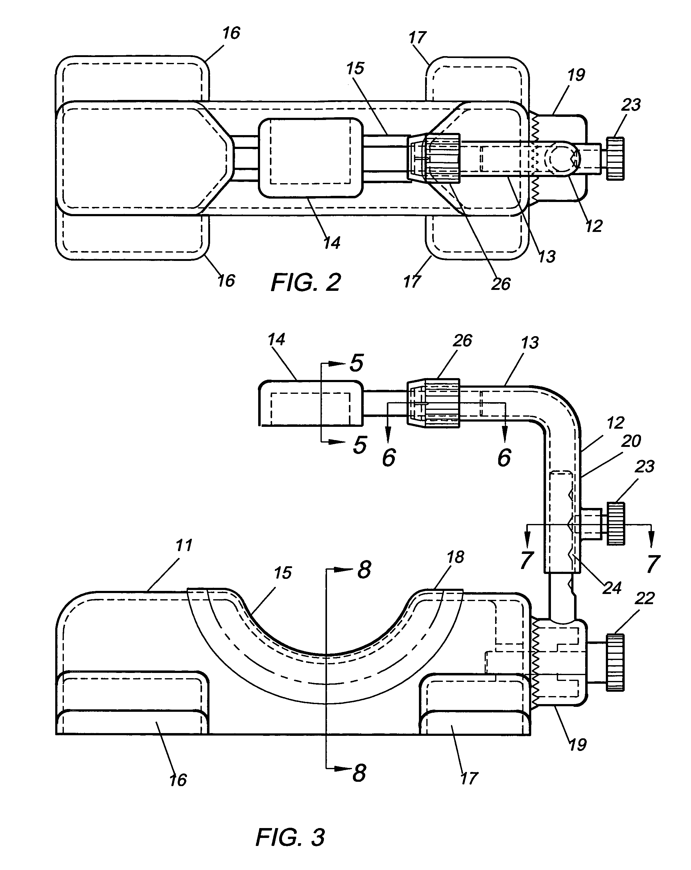 Device and method for maintaining an airway